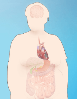 Metabolic Syndrome